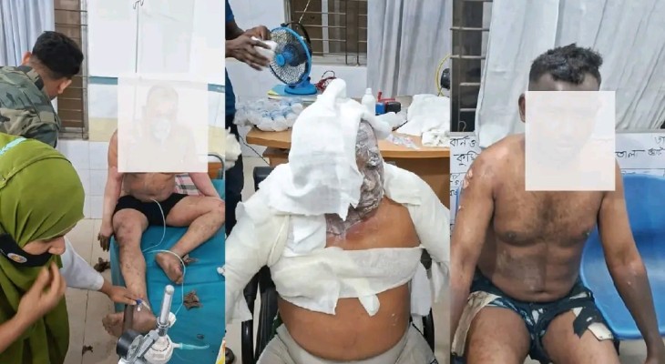 চৌদ্দগ্রামে আমির শার্টস গার্মেন্টসে শর্ট-সার্কিটে তিন শ্রমিক আহত