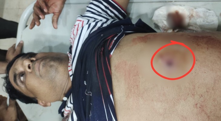 বিএনপি নেতাকে বাঁচাতে গিয়ে গুলিবিদ্ধ সহযোগী