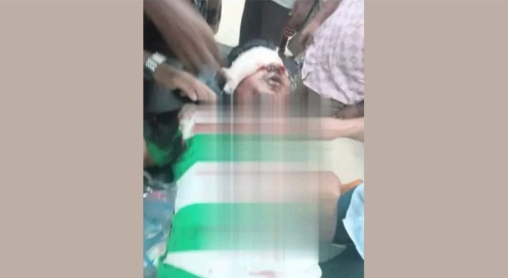 মৌলভীবাজারে কিশোর গ্যাংয়ের হামলায় কিশোর গুরুতর আহত, অবস্থা আশঙ্কাজনক